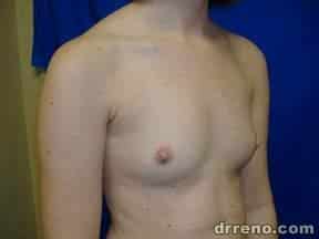 img19169before2